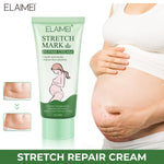 ELAIMEI Anti Stretch Mark Cream, 60ml