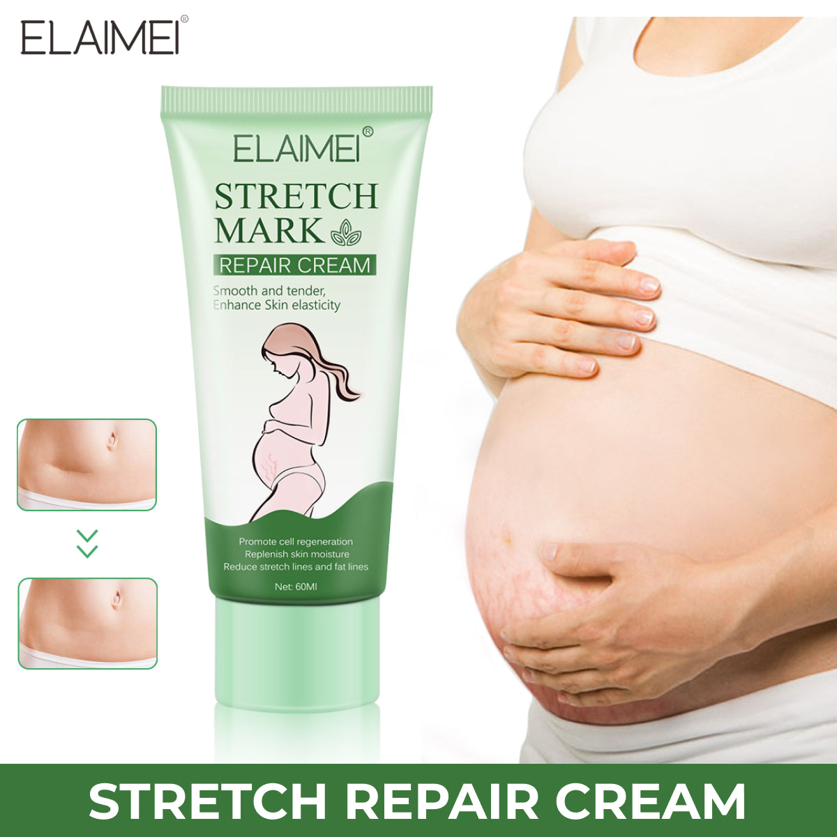 ELAIMEI Anti Stretch Mark Cream, 60ml