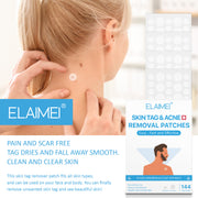 ELAIMEI Patches for Skin Tag & Acne Removal, 144pcs