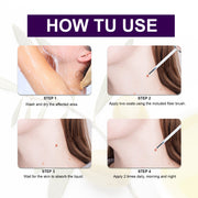 ALIVER Safe Skin Tag Removal Liquid, 30ml