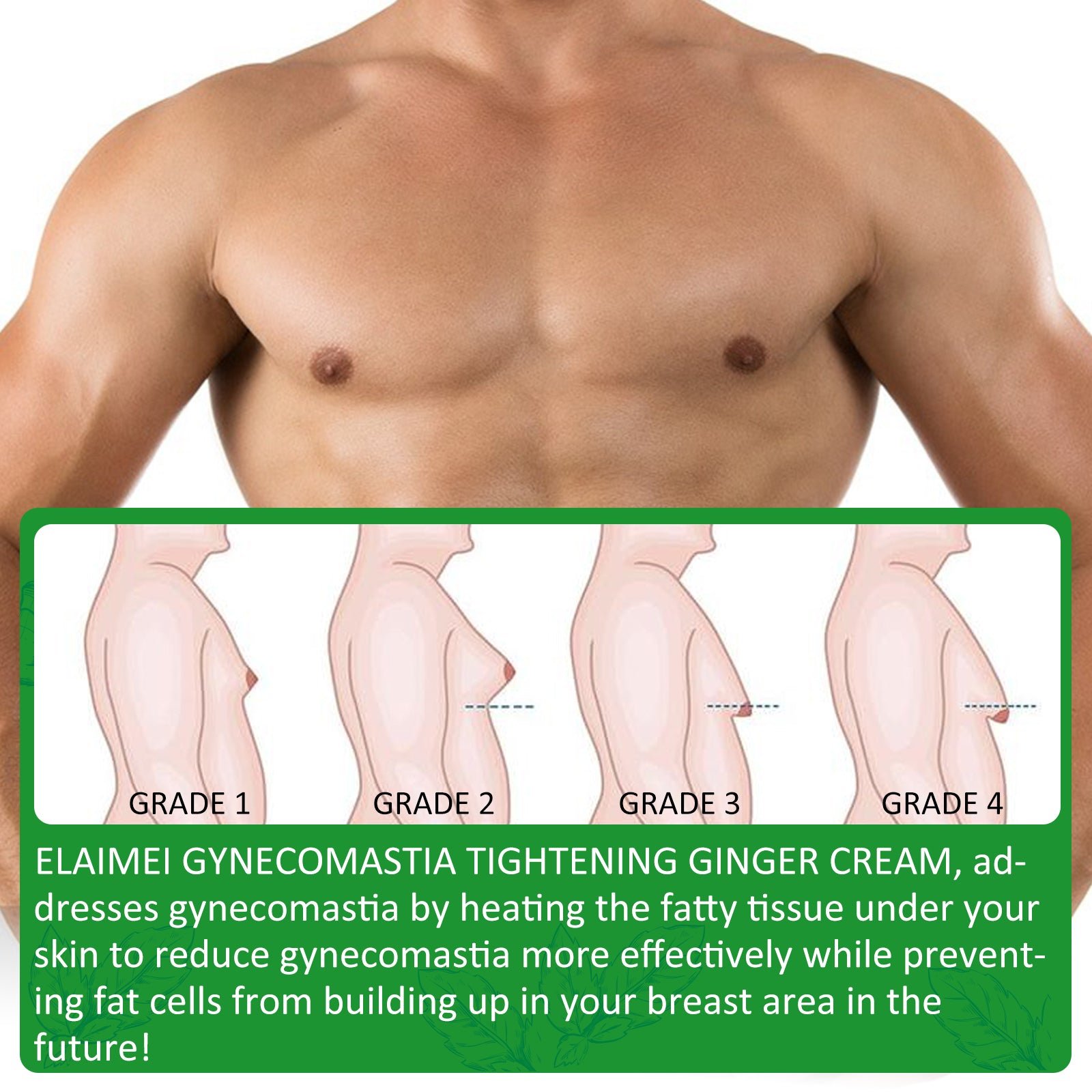 ELAIMEI Gynecomastia Male Breast Treatment Cream, 30ml