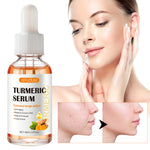 SEFUDUN Turmeric Serum for Dark Spots, 30ml