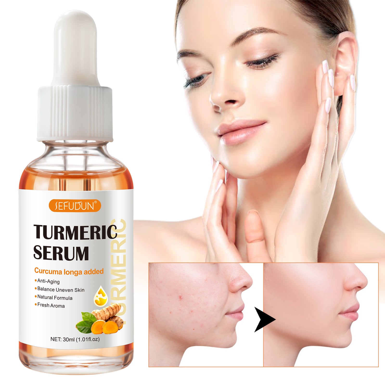 SEFUDUN Turmeric Serum for Dark Spots, 30ml