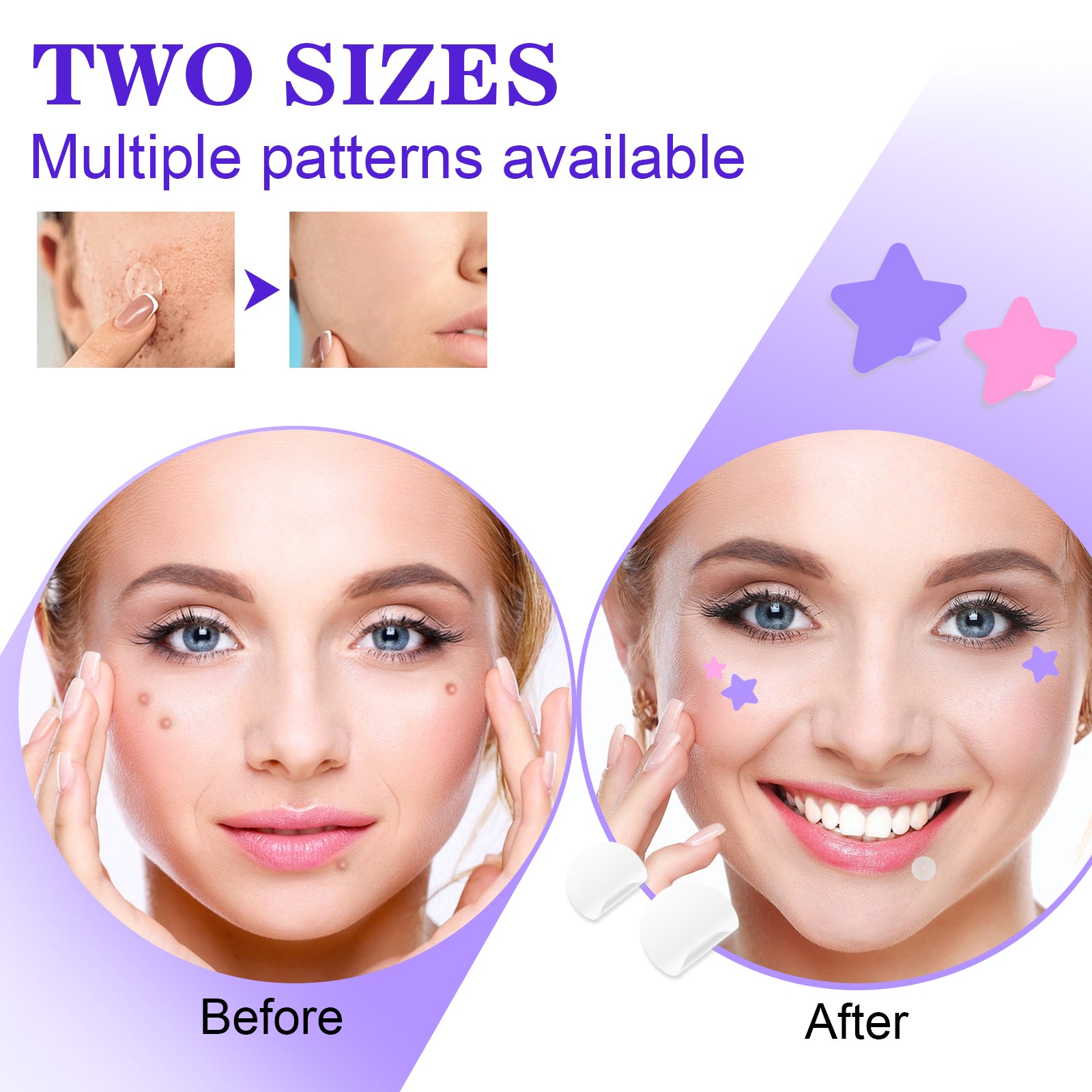 ELAIMEI Stars + Round Pimple Patches, pack of 126pcs