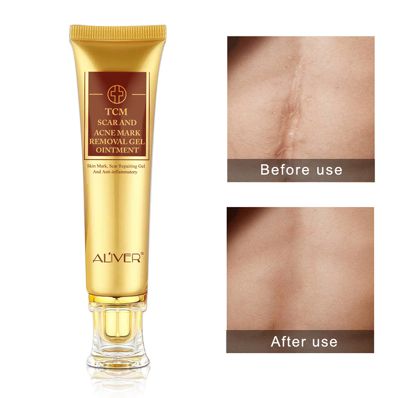 ALIVER Removal Gel Ointment for Scar & Acne Marks, 30ml