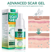 ELAIMEI Advanced Scar Removal Gel for Body, 50ml
