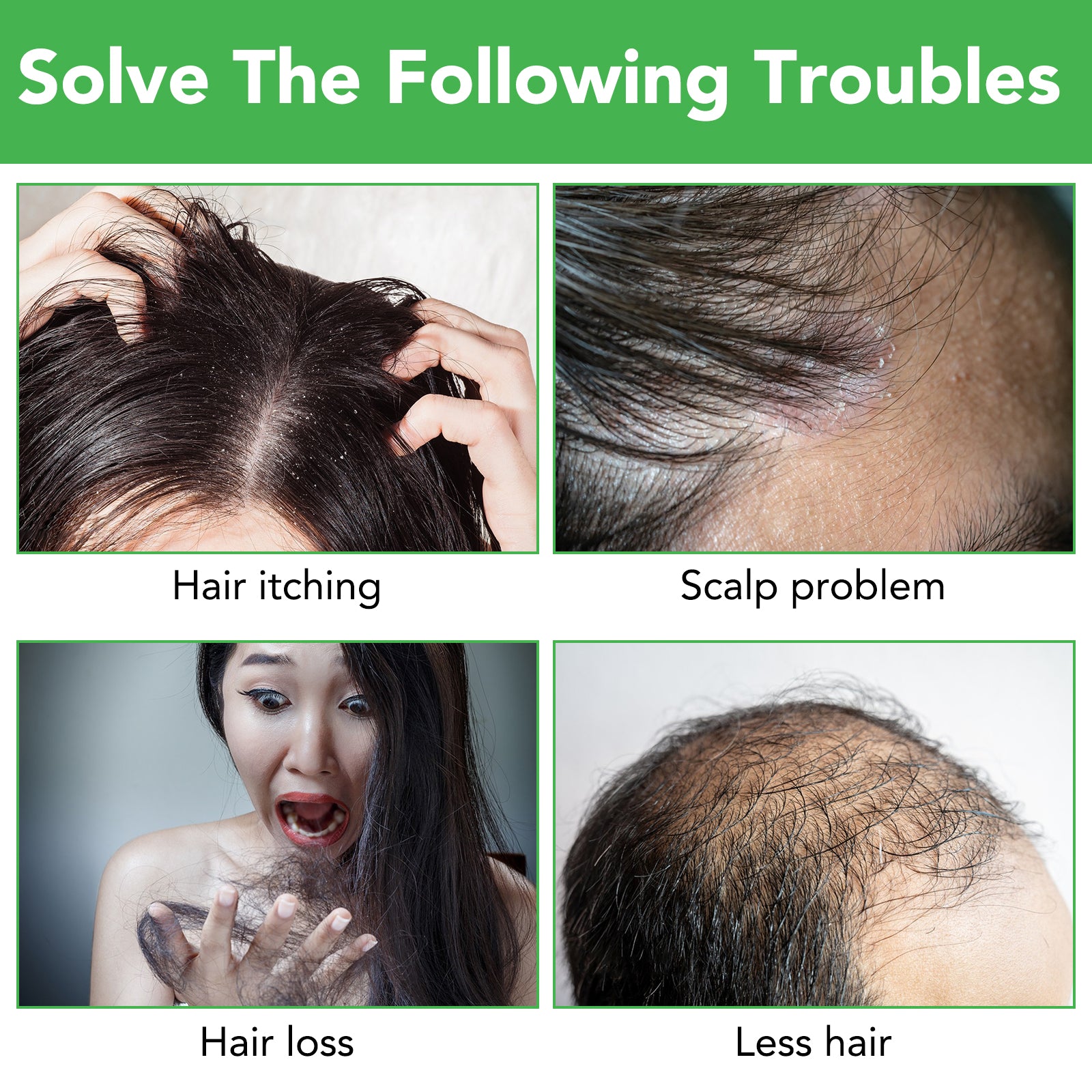 ALIVER Rosemary Hair Growth Shampoo, 300ml