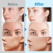 ALIVER Glycolic Acid Exfoliating Pads, 40pcs