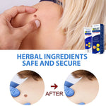 SEFUDUN Skin Tag & Wart Removal Cream, 20g