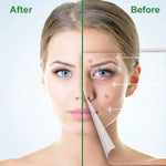Elaimei Removal Acne Pimple Patches Treatment