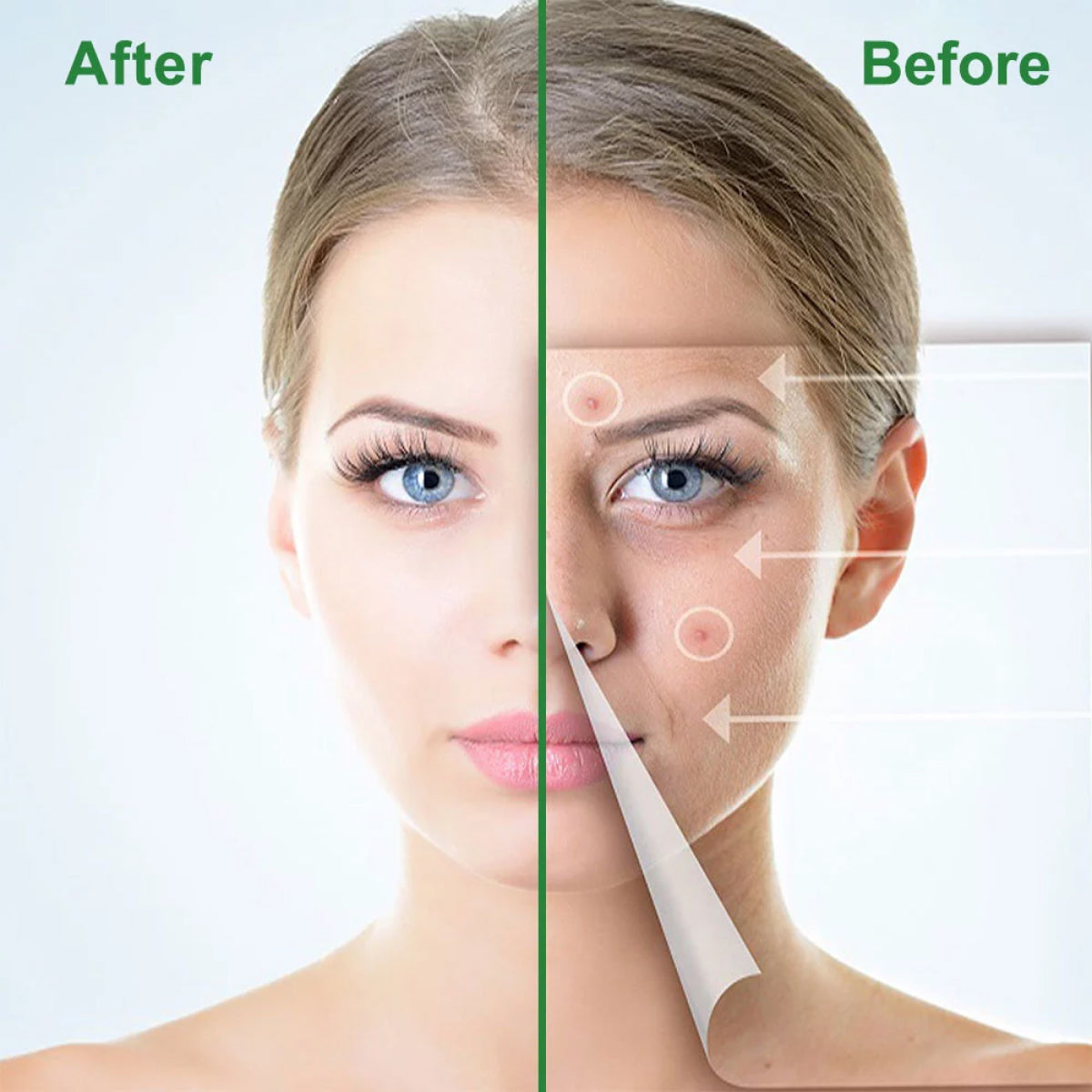 Elaimei Removal Acne Pimple Patches Treatment