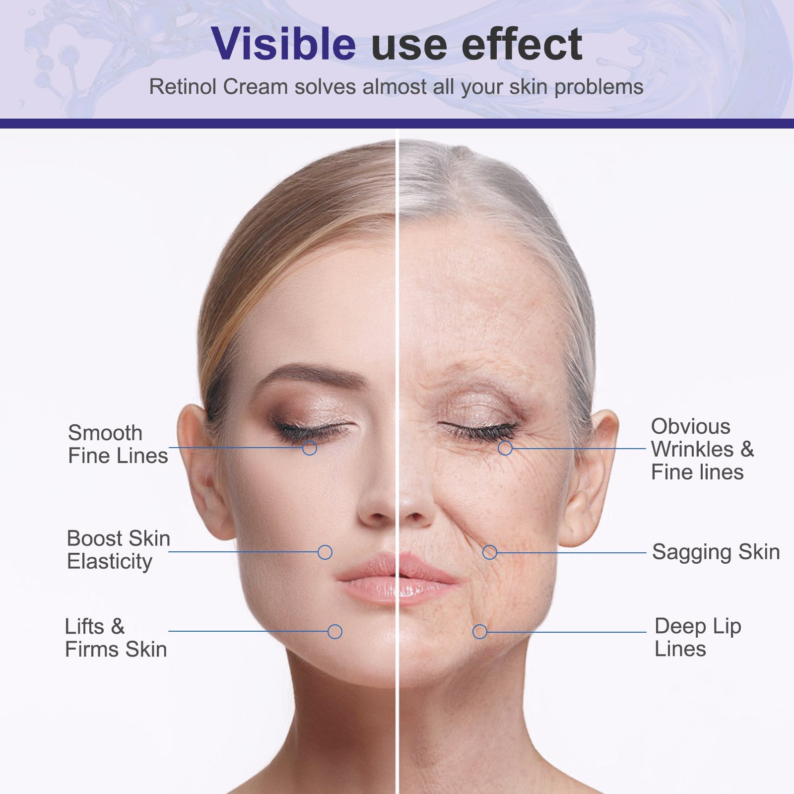 Kizenka Retinol Face Cream Moisturizer Skin Care Anti Aging Wrinkle Acne Treatment Day and Night Cream Dark Spot Remover