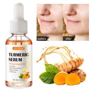 SEFUDUN Turmeric Serum for Dark Spots, 30ml