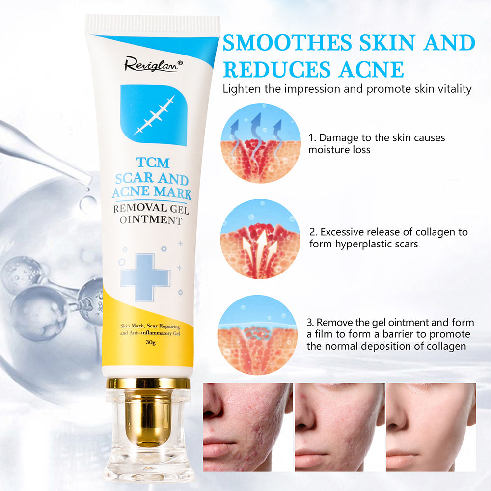 REVIGLAN TCM Scar And Acne Mark Removal Gel Ointment, 30g