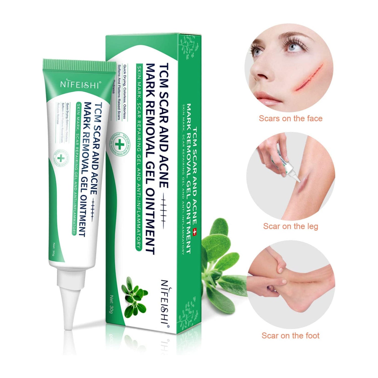 Nifeishi  Advanced Scar Removal Gel Cream Treatment Repair Acne Marks Ointment Skin Care
