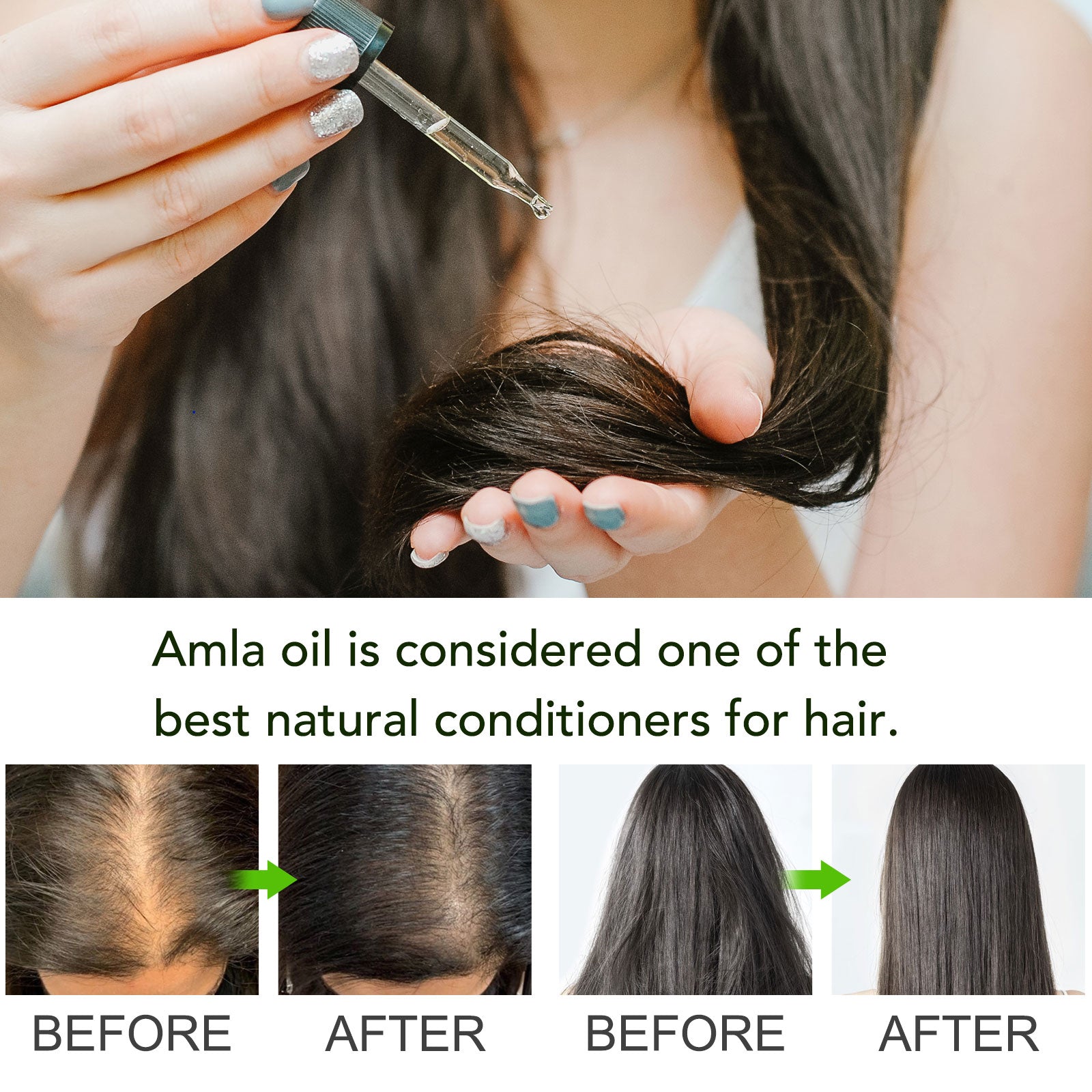 ALIVER Amla Oil for Hair Growth, 60ml