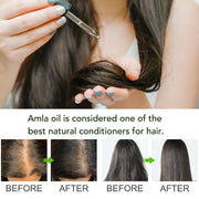 ALIVER Amla Oil for Hair Growth, 60ml