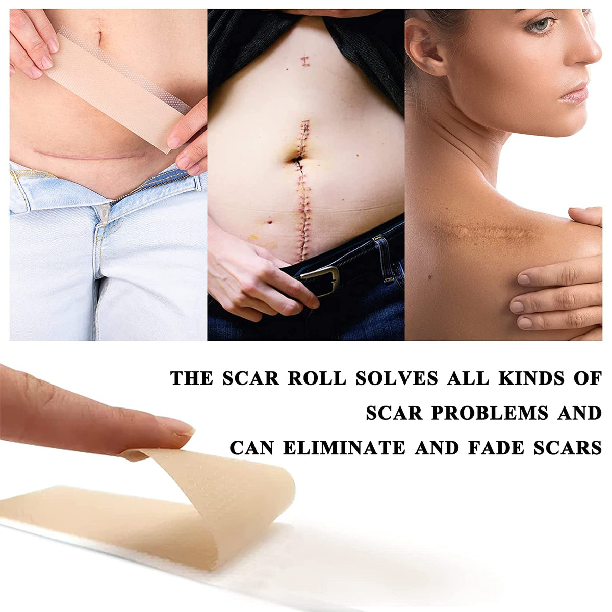 Elaimei Silicone Gel Sheet Roll for Scar Removal Treatment Tape 1.5M