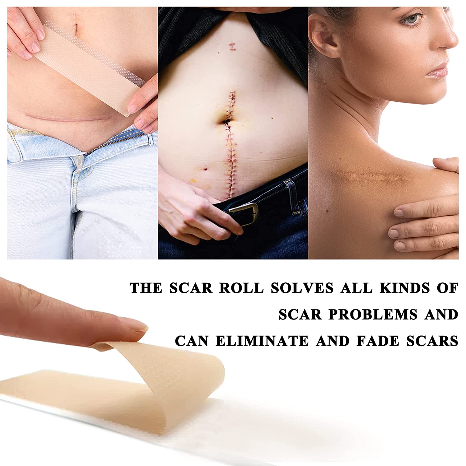 Elaimei Silicone Gel Sheet Roll for Scar Removal Treatment Tape 1.5M