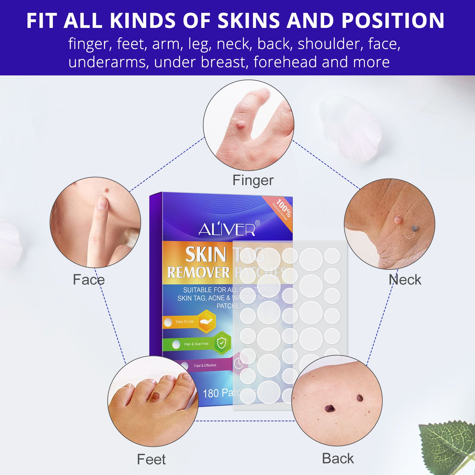 ALIVER Safe Skin Tag Remover Patches, pack of 180pcs