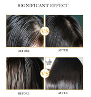 Elaimei Anti Hair Loss Treatment Shampoo for Men Women