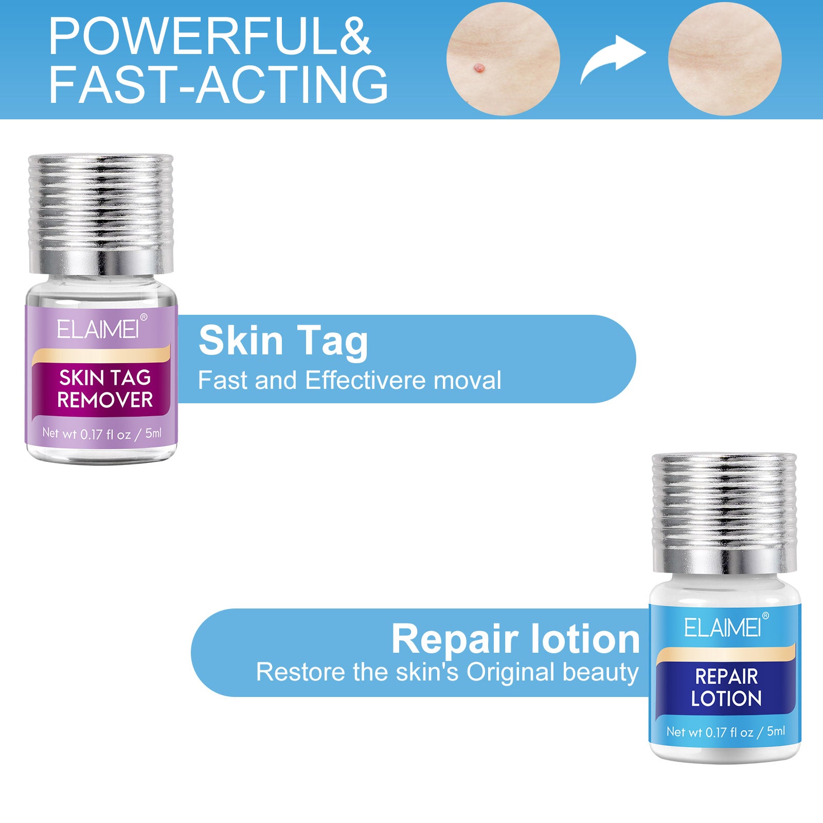 ELAIMEI 2in1 Skin Tag Remover & Repair Lotion