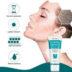 Aliver Dark Spot Remover Corrector Brighter for Face Body Skin Cream