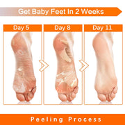 ALIVER Peach Soft Foot Peel Mask, 3in1 Kit