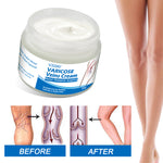 VOGSIG Varicose Veins Cream, 50g