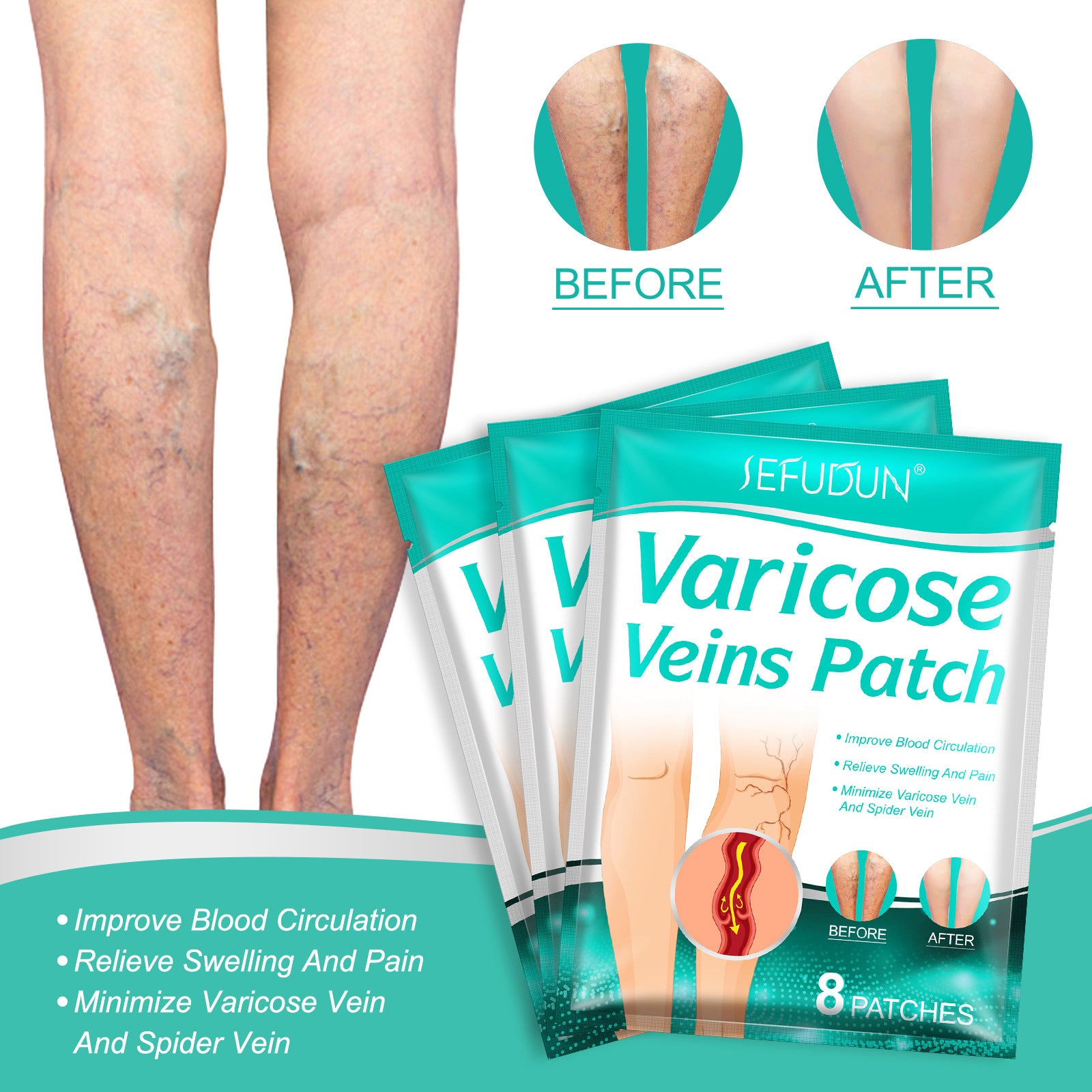 Varicose Veins Patch Treatment for Legs Relief Pain Vasculitis, Spider Vein Strengthen Capillary Health Blood Circulation Vein Care Fading  (8 count)