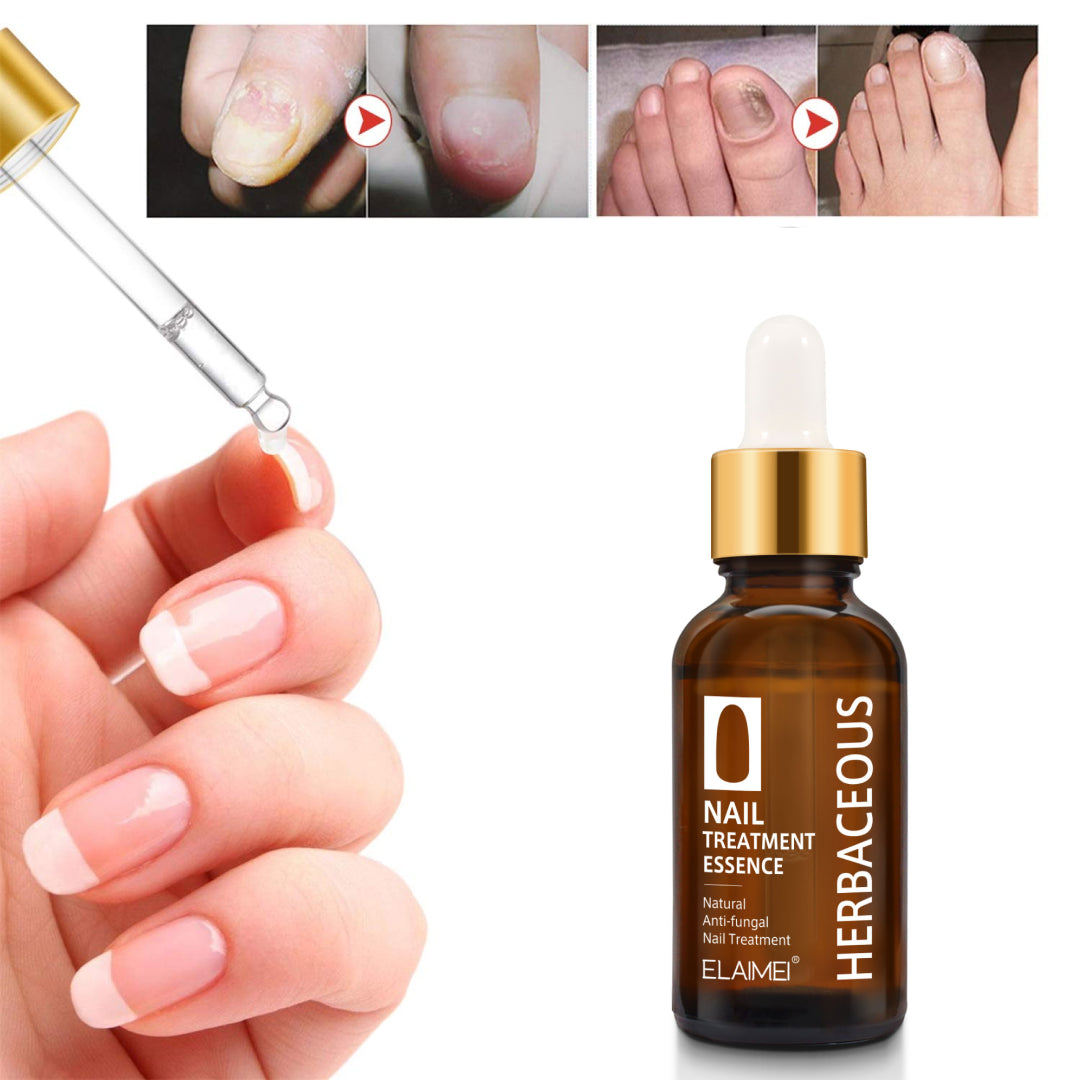 ELAIMEI Natural Anti-Fungal Nail Essence, 30ml