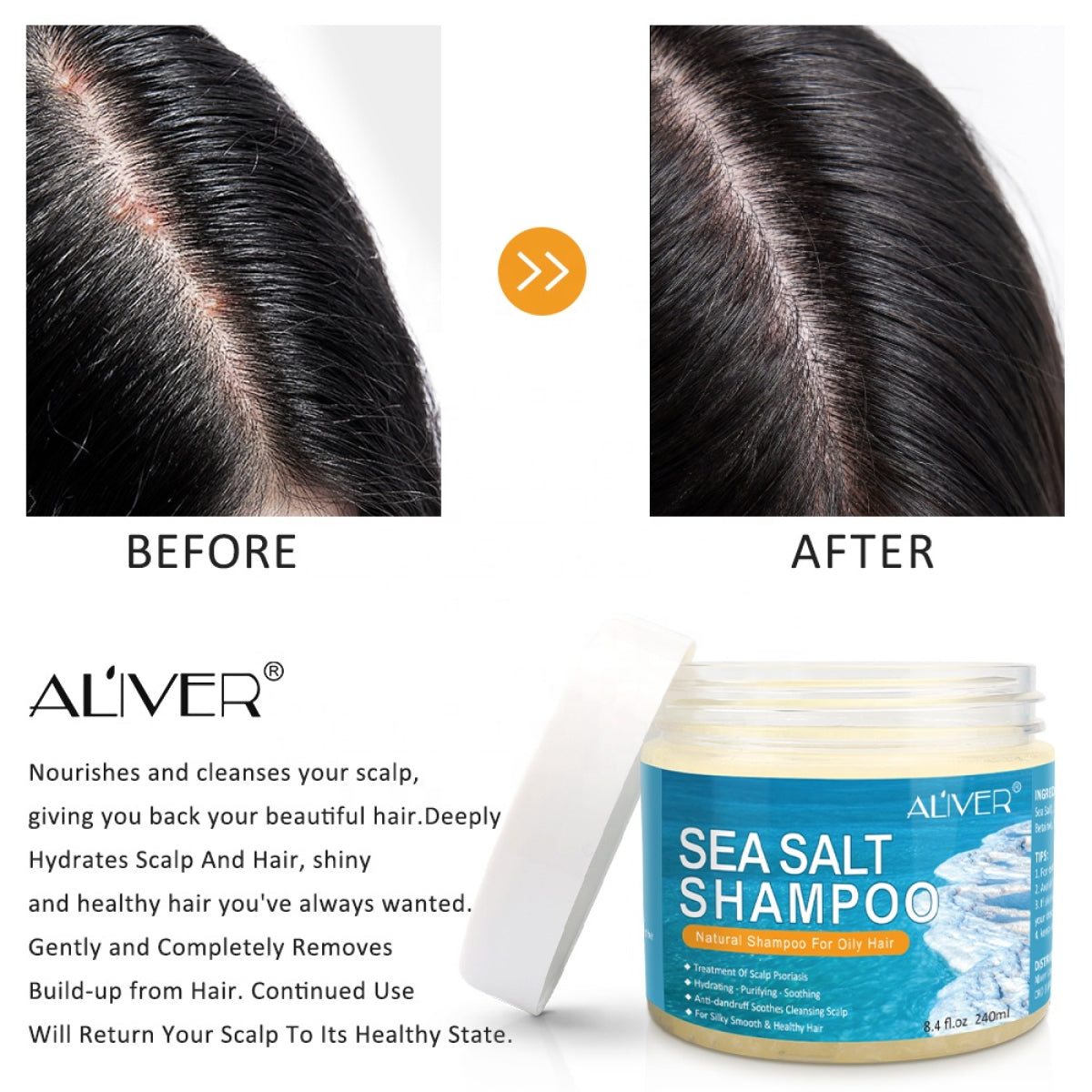 Aliver Natural Sea Salt Shampoo Hair Anti Dandruff Treatment