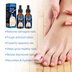 SEFUDUN Removal Paronychia Oil, 30ml