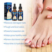 SEFUDUN Removal Paronychia Oil, 30ml