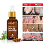 Aliver Fungus Nail Anti Fungal Infection Oil Treatment