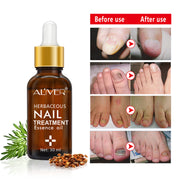 Aliver Fungus Nail Anti Fungal Infection Oil Treatment