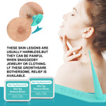 ELAIMEI 2in1 Fast & Effective Skin Tag Remover Kit