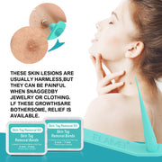 ELAIMEI 2in1 Fast & Effective Skin Tag Remover Kit