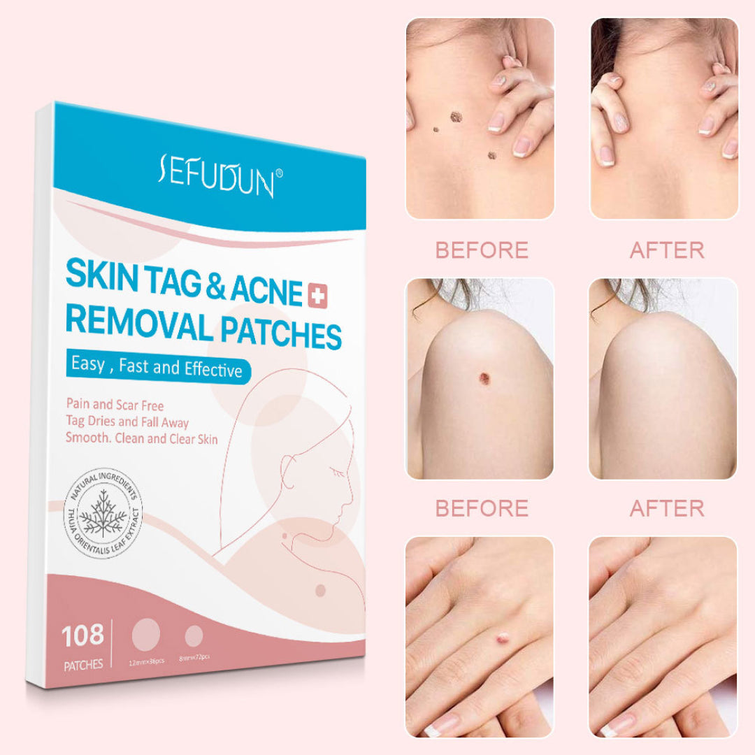 SEFUDUN Skin Tag & Acne Removal Patches, pack of 108pcs