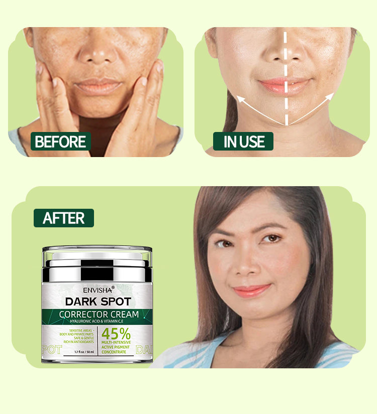 ENVISHA Dark Spot Corrector Cream, 50ml