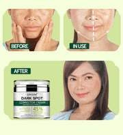 ENVISHA Dark Spot Corrector Cream, 50ml