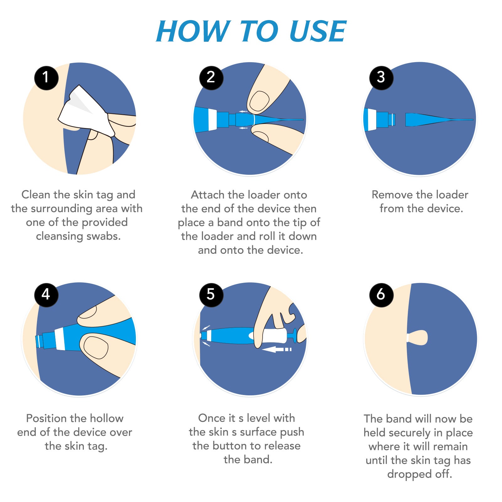 ALIVER 2in1 Gentle Skin Tag Removal Kit