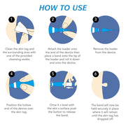 ALIVER 2in1 Gentle Skin Tag Removal Kit