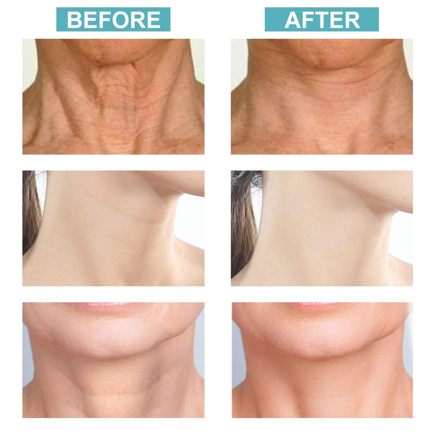 Aliver Firming Neck Skin Cream Roller for Facial Lifting Massage