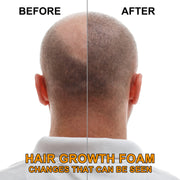 ELAIMEI Hair Regrowth Foam, 60ml