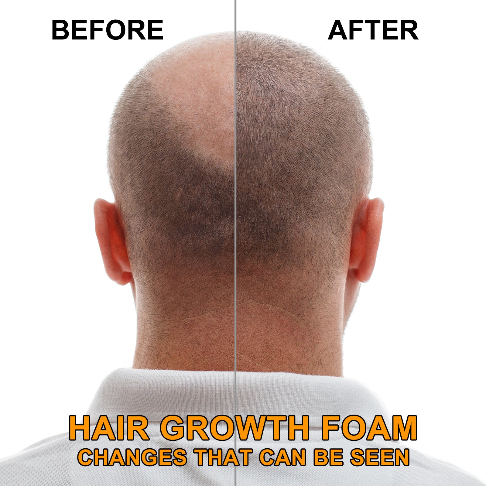 ELAIMEI Hair Regrowth Foam, 60ml