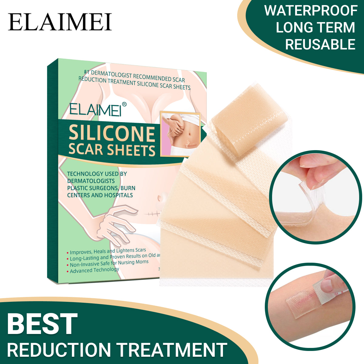 Elaimei Silicone Sheets for Scar Removal