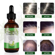 ALIVER Rosemary Hair Growth Oil, 60ml