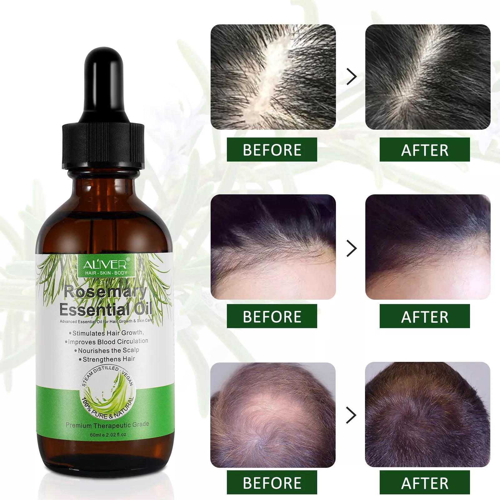 ALIVER Rosemary Hair Growth Oil, 60ml