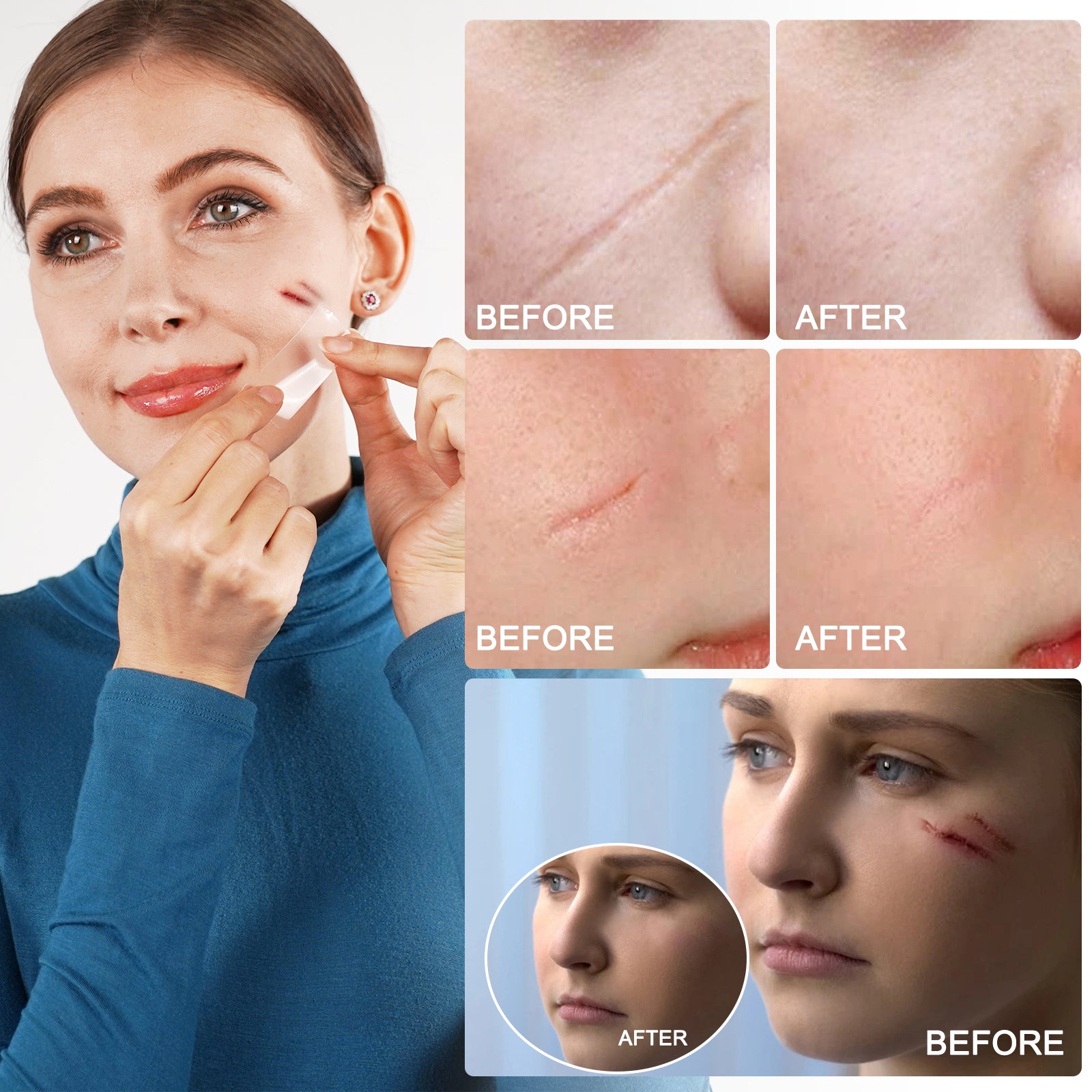 ALIVER Silicone Scar Removal Sheet, 1.5m